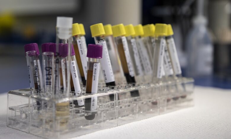 Photo of Профилактика и лечение гепатита