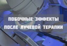Photo of ак легких: химиотерапия и лучевая терапия