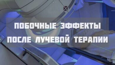 Photo of ак легких: химиотерапия и лучевая терапия