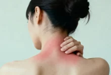 Photo of Симптомы и лечение аллергии