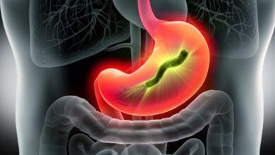 Photo of Симптомы гастрита и его лечение