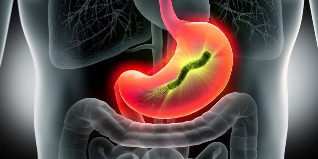 Фото 27 — Симптомы гастрита и его лечение