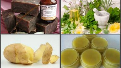 Photo of Лечение псориаза народными методами