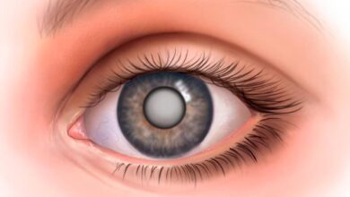 Photo of Симптомы и лечение катаракты