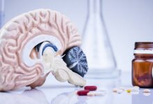 Photo of Склероз: лекарства и реабилитация