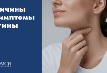 Photo of Эффективные методы лечения ангины