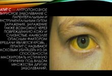 Photo of Симптомы и методы лечения гепатита