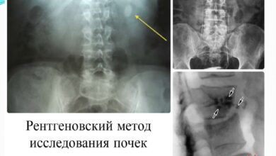 Photo of Гломерулонефрит: противовоспалительные препараты и анализы