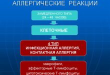 Photo of Симптомы и методы лечения аллергических реакций