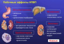 Photo of Артрит: противовоспалительные препараты и физиотерапия