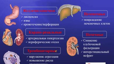 Photo of Артрит: противовоспалительные препараты и физиотерапия
